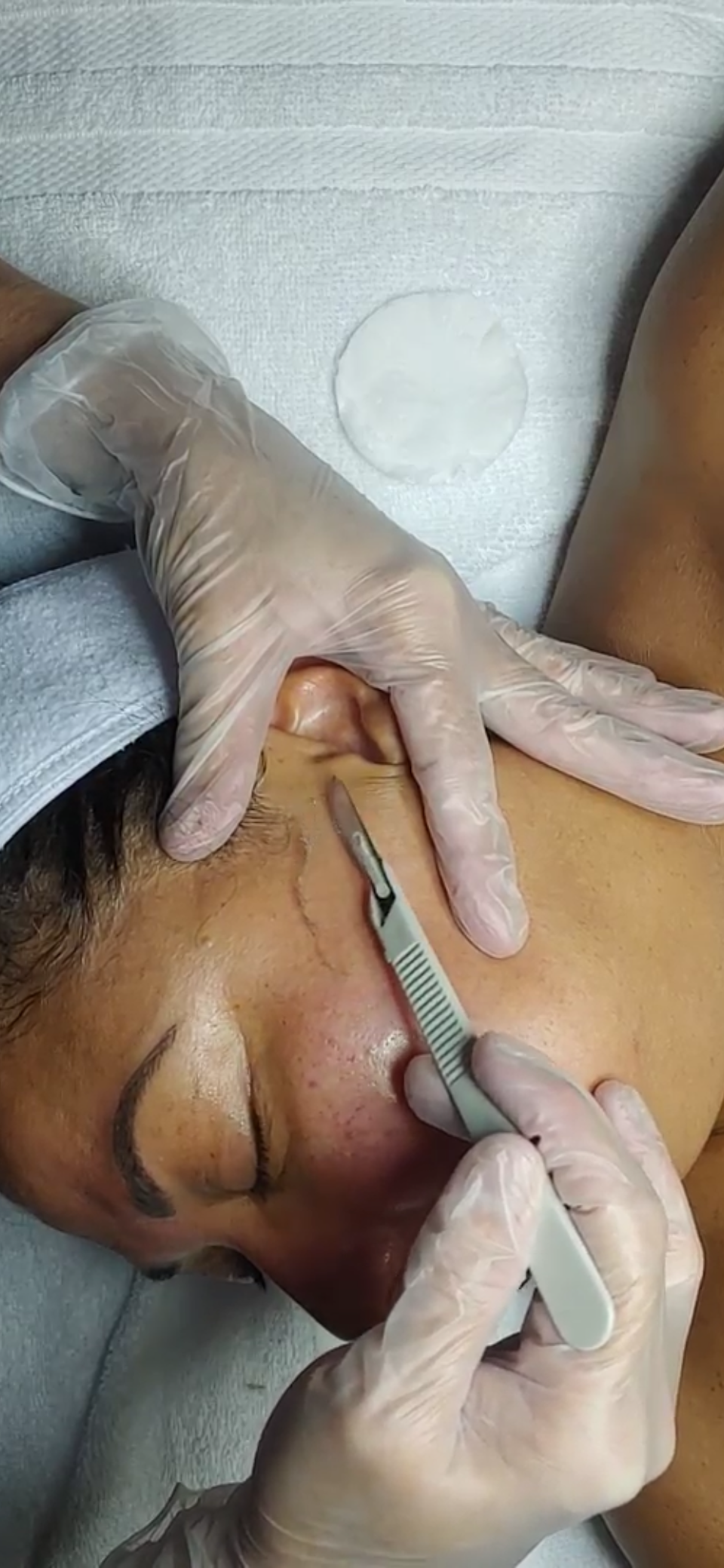 Dermaplaning Class 2025